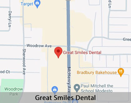 Map image for Multiple Teeth Replacement Options in Modesto, CA